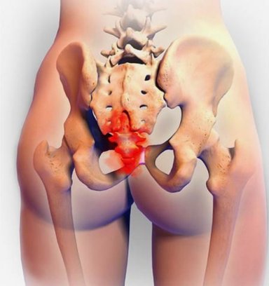 Ondt i halebenet, halbenssmerter, behandling af halveben, smerter når man sidder ned, osteopati, fysioterapi ballerup og København