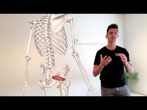 Fjern Iskiassmerter, piriformissyndrom, iskias, iskiasnerve problemer.